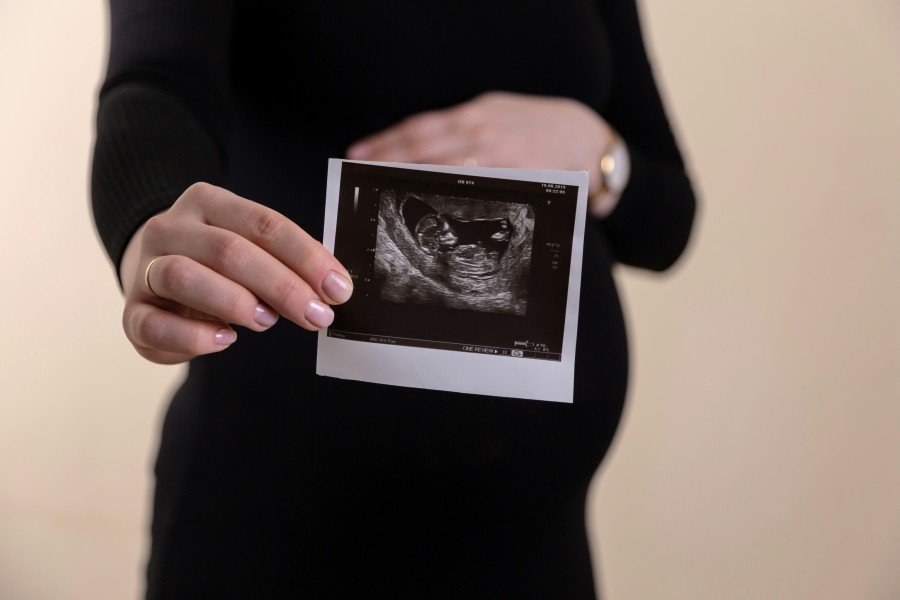 Pregnant woman holding an ultrasound scan image during a prenatal consultation